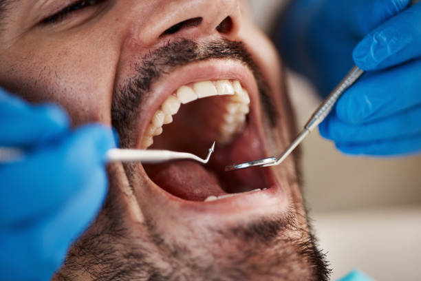Best Cracked Tooth Emergency Dentist  in New Buffalo, MI